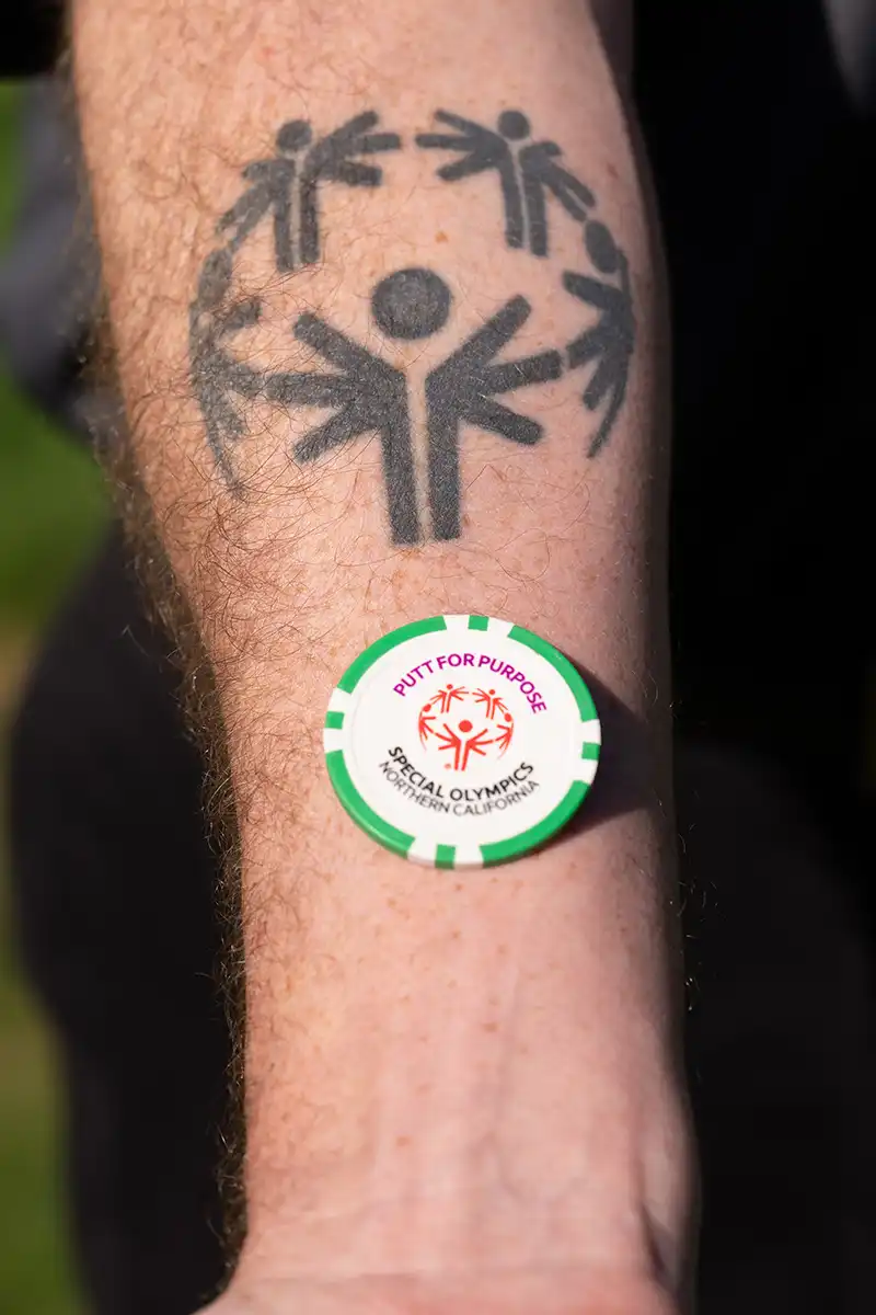 High Tech Challenge Gallery Image03 - Tattoo Arm